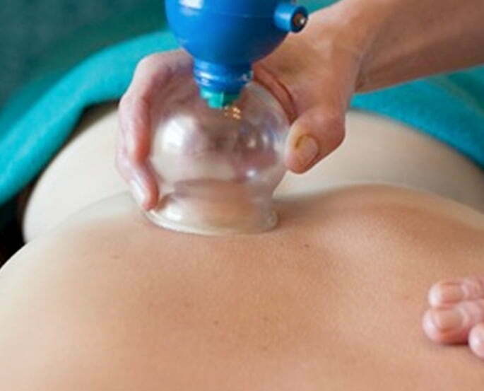 Transformational Cupping